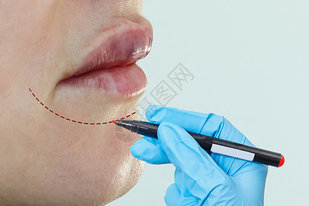 整形外科医生根据病人下巴  整容外科概念来进行治疗女孩老化皮肤嘴唇药品女性皱纹手术化妆品成人图片