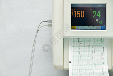 用于测量收缩 孕妇在医院的心跳的监视器;以及图片