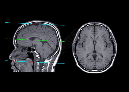 核磁共振大脑比较轴心和人造飞机图片