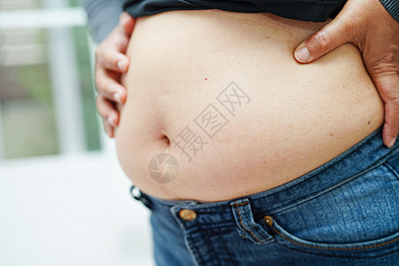 加傍亚裔女性在办公室显示胖肚子大超重和肥胖症肌肉展示外科尺寸腰部工作手术烧伤塑料肥胖背景