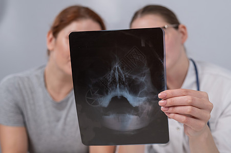 一名女医生和一名病人在接待处讨论鼻腔X光片问题 并正在讨论这个问题鼻子接待疾病诊断医院创伤颅骨考试诊所x光图片