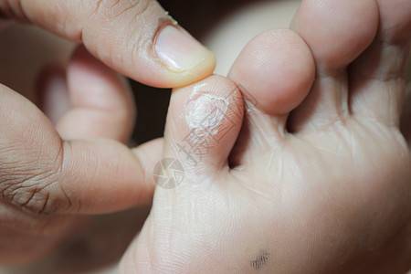 近身的年轻人在床上干燥的脚治疗护理后代保健美容皮肤皮肤科脚趾水分孩子们图片