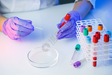 医学专家 实验室助理 医生在实验室进行分析 使用试管 移液器和培养皿来检测人体中细菌的存在液体样本药品生物研究实验玻璃技术测试团图片