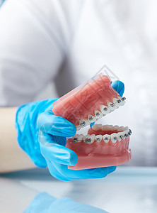 医生矫形医师展示人类下巴的模型 并配有铁丝牙套塑料示范技术治疗卫生支撑牙齿牙医诊所陶瓷图片