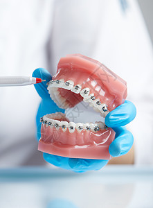 医生矫形医师展示人类下巴的模型 并配有铁丝牙套技术金属陶瓷保健牙医牙齿口服示范牙科矫正图片