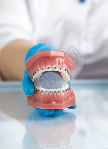 医生矫形医师展示人类下巴的模型 并配有铁丝牙套药品卫生牙科牙齿金属技术办公室塑料示范陶瓷图片