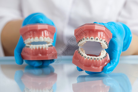 矫形医生展示人类下巴的模型 配有铁丝牙套和导线师解释差异制品诊所牙医塑料矫正治疗技术支撑陶瓷金属图片