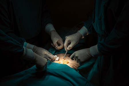 在消毒手术室为病人做手术的特勤外科小组药品医院助手专家情况医生医师疾病医护人员程序图片