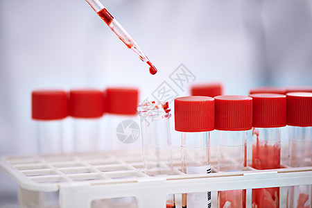 是时候分析你的血液了 一名科学家在实验室里用血样做实验图片