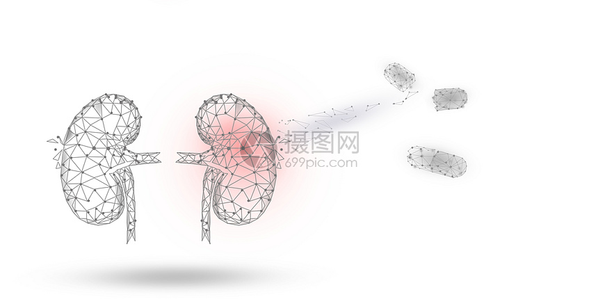 肾脏疾病治疗图片