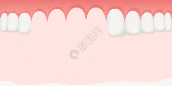 健康牙齿种植牙齿GIF高清图片