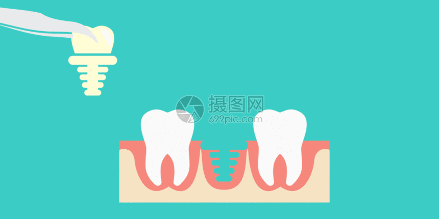 拔除坏掉牙齿插画gif动图图片-正版gif素材401311307-摄图网