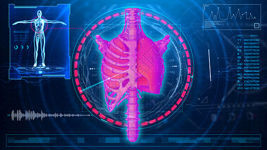 科技医疗肺部分析场景图片
