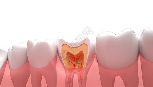 牙齿疾病C4D护牙高清图片