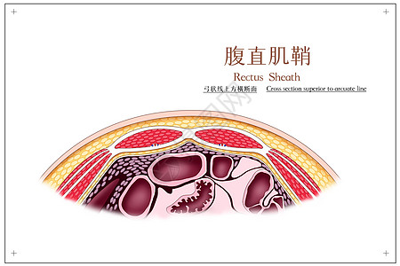 腹直肌鞘弓状线上方横断面医疗插画高清图片