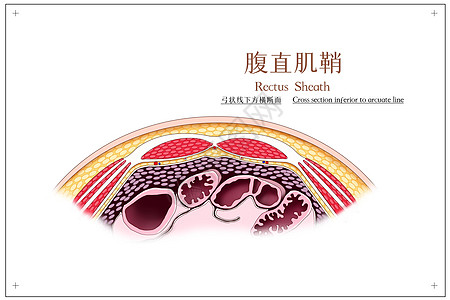 腹直肌鞘弓状线下方横断面医疗插画图片