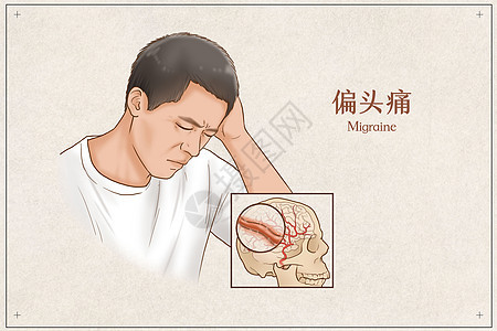 偏头痛医疗插画神经内科高清图片素材