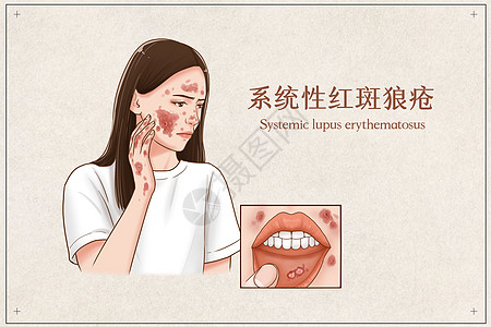 老年医疗系统性红斑狼疮医疗插画插画