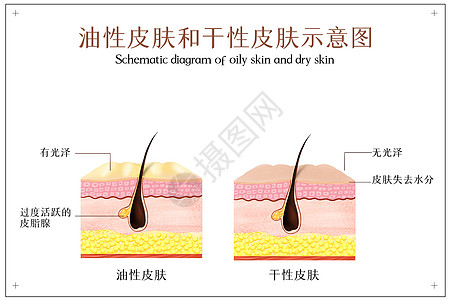 皮克油性皮肤和干性皮肤示意图插画