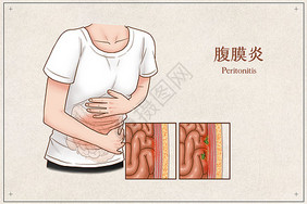 腹膜炎医疗插画医疗健康高清图片素材