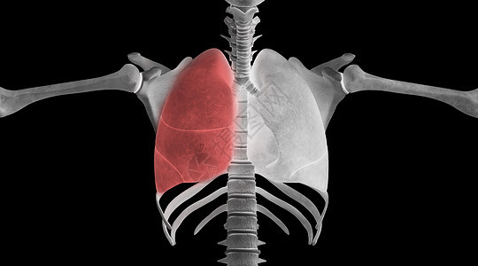 人体肺部病变场景图片
