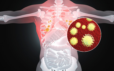 人体肺部病毒病变图片