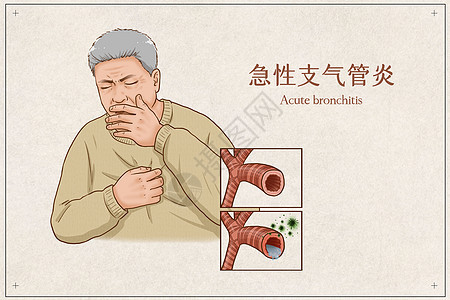 急性支气管炎医疗插画图片