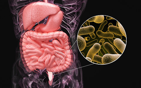 人体肠道感染图片