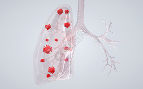 肺病人体肺部病变感染设计图片