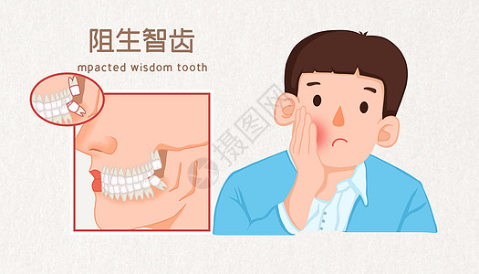 生牛肉块阻止智齿牙周炎医疗插画插画