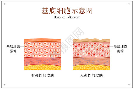 分层分类皮肤基底细胞示意图插画