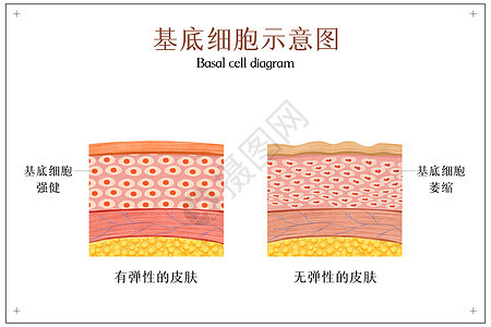 皮肤基底细胞示意图图片