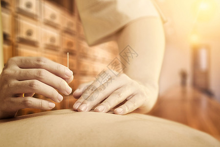 中医针灸传统保健高清图片