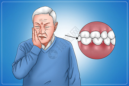 糖尿病症状牙龈反复发炎医疗插画高清图片