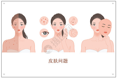 医疗女人女性各种皮肤问题插画