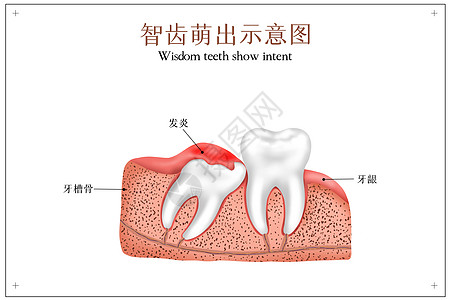 智齿萌出示意图背景图片