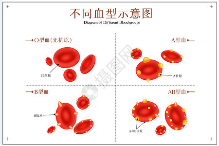 不同血型示意图图片