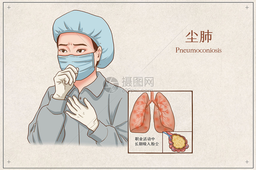 尘肺医疗插画图片