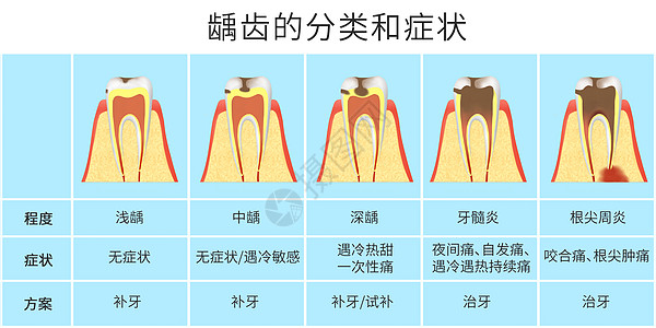 替换文字分类结构图龋齿的分类和症状科普医疗插画插画