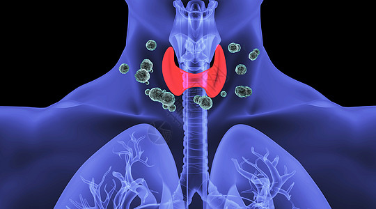 人体甲亢场景图片