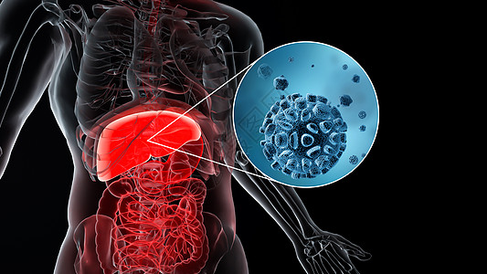 3D肝脏疾病场景图片
