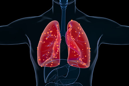 4d肺部感染病变场景设计图片