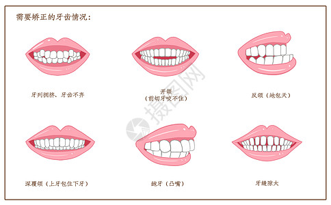 医疗保健需要矫正的牙齿口腔医学配图插画