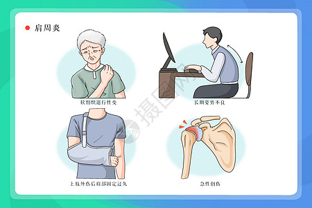 肩周炎病因医疗插画图片