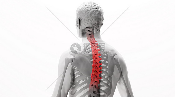 人体脊椎病场景图片
