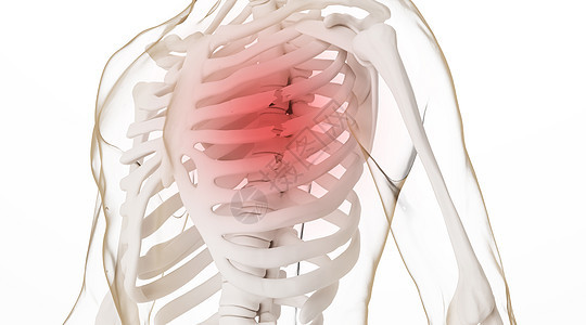 胸部肋骨骨折场景图片