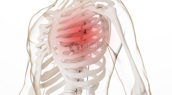 胸部肋骨骨折场景图片