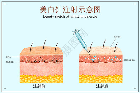 美容美妆美白针注射示医美配图插画