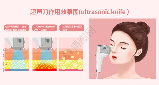 超声刀作用效果图图片