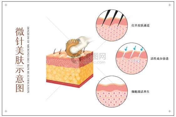 微针美肤医美配图图片